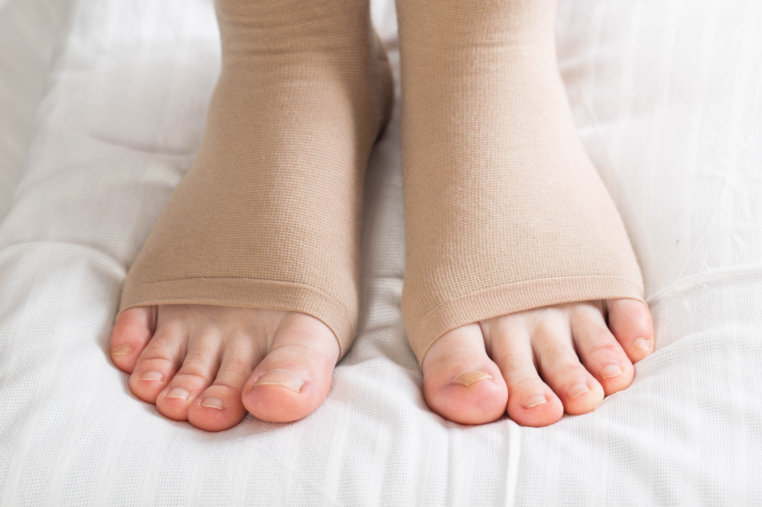 Flebite - Clinica Vascolare